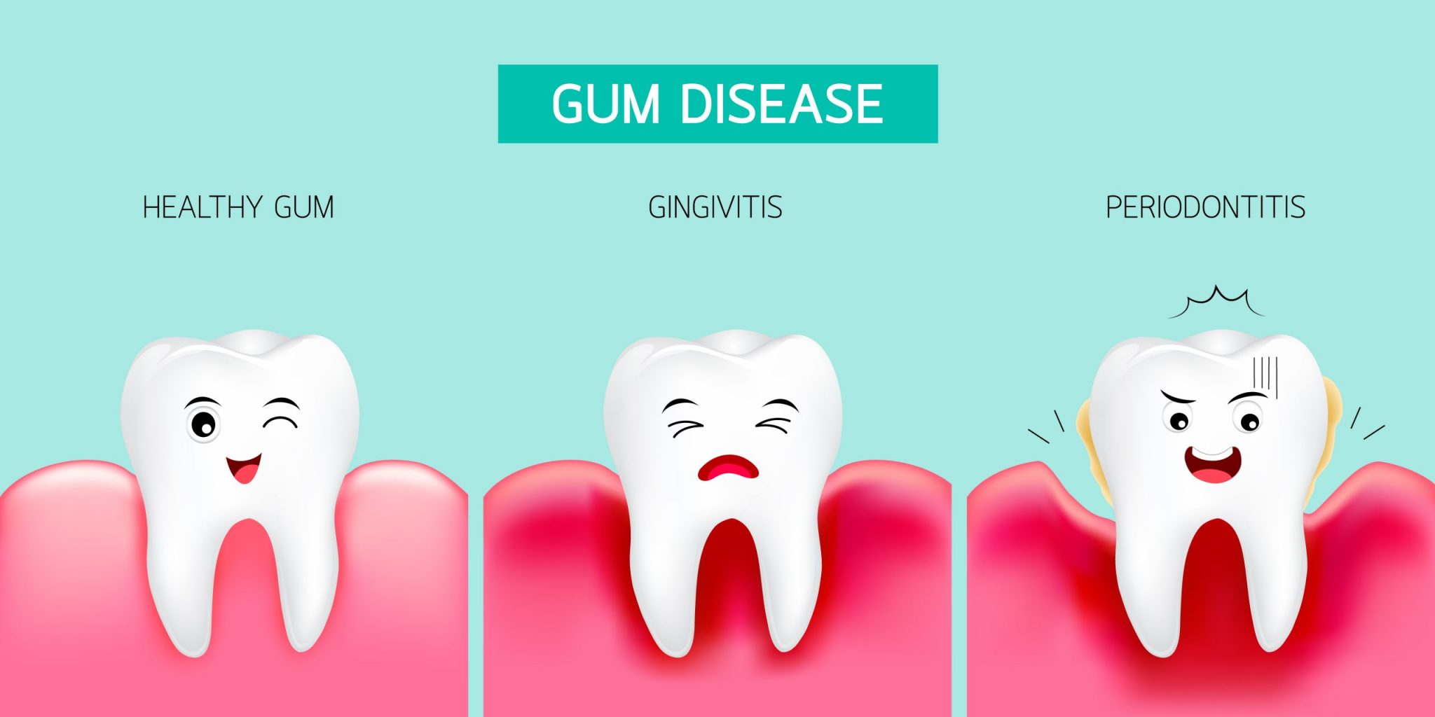 gum-disease-awareness-dental-arts